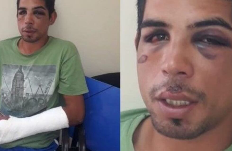 Intentó robar una moto y ahora su abogada asegura que su cliente es la víctima