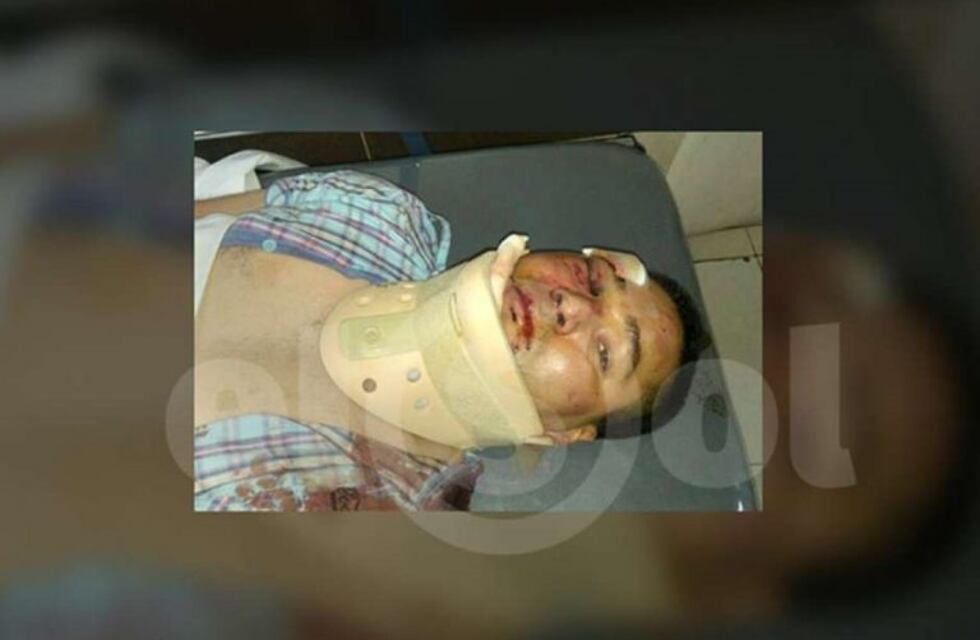 Dura golpiza a un policía en taller mecánico de Las Heras