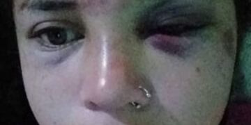 María Belén fue brutalmente atacada por su ex pareja delante de sus hijas y amenazada de muerte