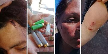 Barrios de Pie denuncia violencia policial en San Luis\u002E