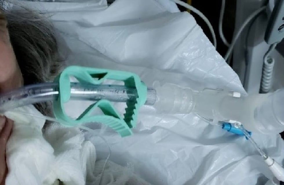 Dos hospitales ya utilizan el equipamiento médico para respiradores de la UNLP