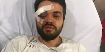 Jonathan Castellari\u002E