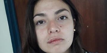 Salas recibió una piña que le partió el labio\u002E