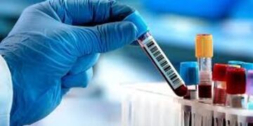 Test Coronavirus - Gualeguaychú asciende a 214 casos\u002E\nCrédito: Web