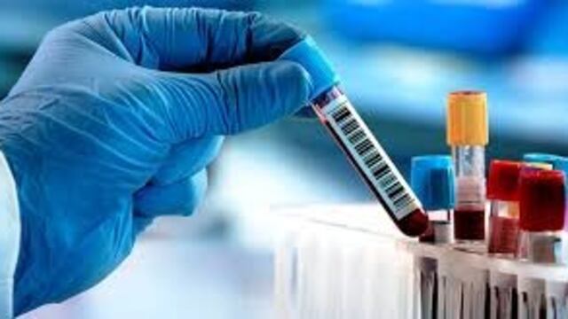 Test de Coronavirus/Web