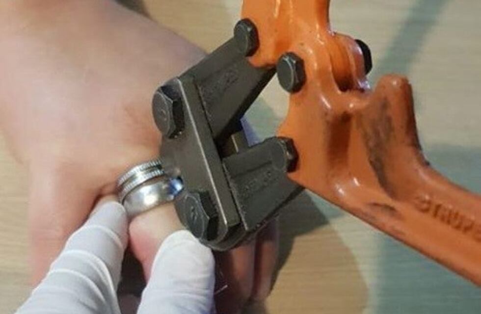 Concordia: se le trabó un anillo en el dedo y los bomberos tuvieron que intervenir para extraérselo