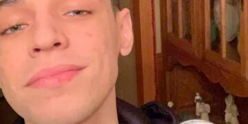 El pulgar gigante de un joven es furor en redes