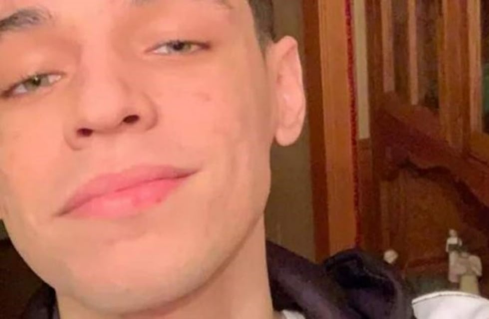 Impresionante: el joven que se hizo viral por tener un pulgar gigante