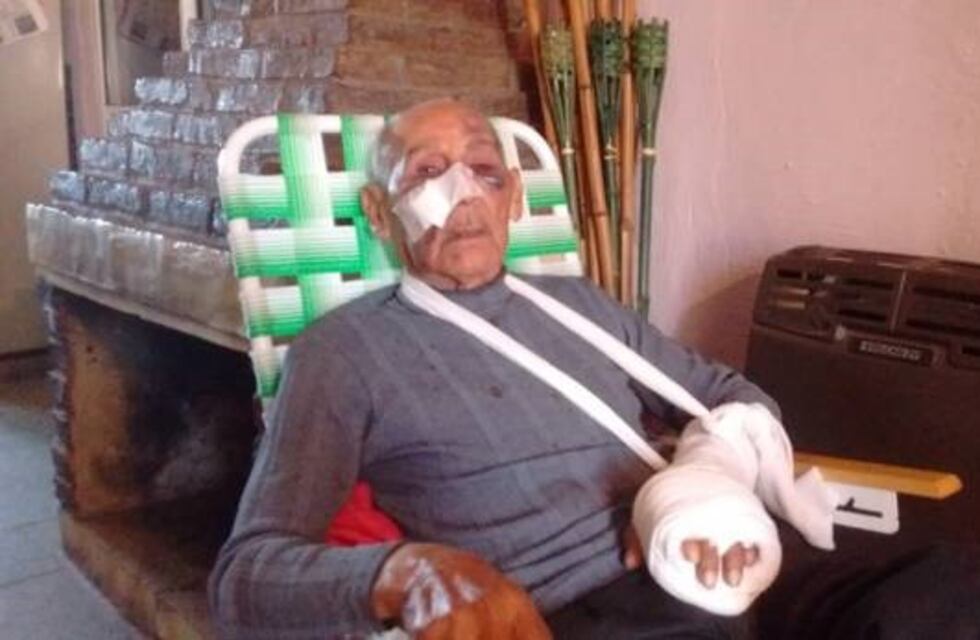 ¡Qué crueldad! El relato en primera persona del anciano que fue brutalmente golpeado para robarle