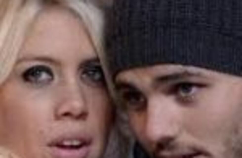 ¿Por qué todos hablan de los dientes de Wanda?