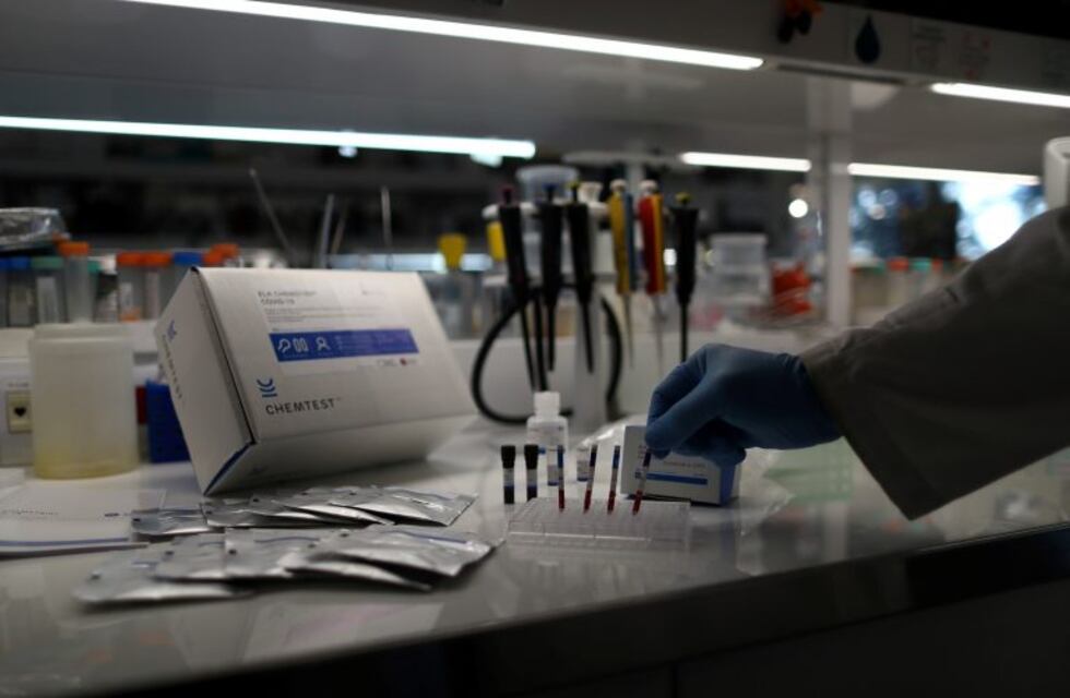 Se realizaron más de 100.000 ensayos en el país con el test serológico para detectar anticuerpos en el plasma