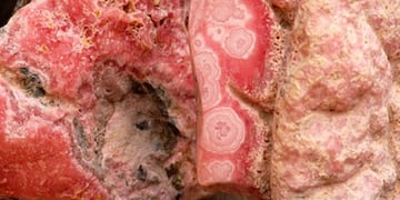 Minería en Catamarca\u002E