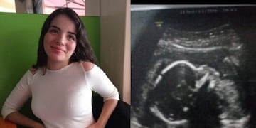 Tiene seis meses de embarazo y para que su beba nazca con vida debe viajar a EE\u002EUU\u002E