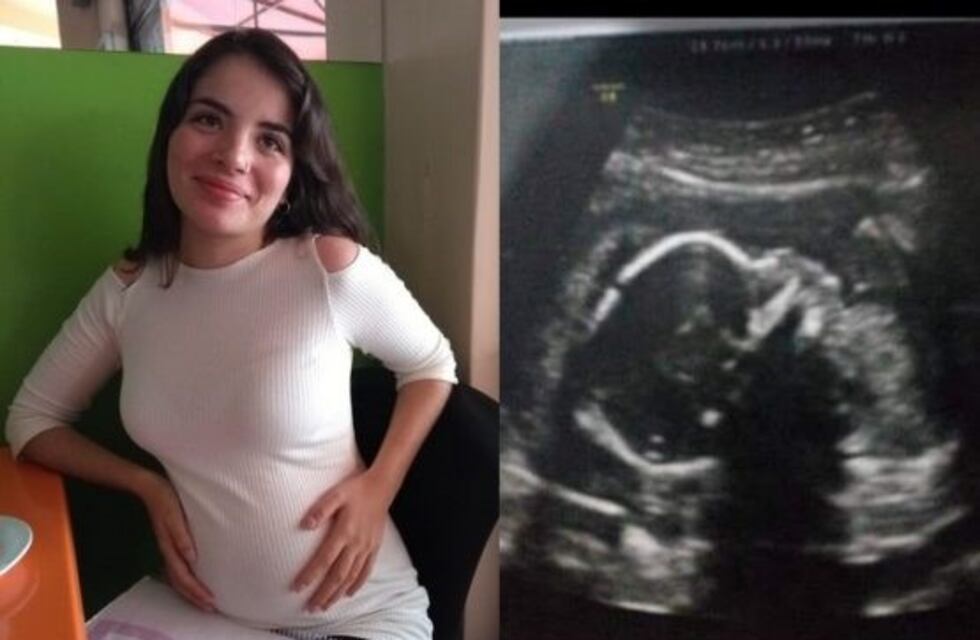 Una puntana embarazada necesita un tratamiento millonario para que su beba nazca con vida
