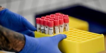 Berlin (Germany), 18/08/2020\u002E- An view of vials inside of the Corona Test station at the main railway station Hauptbahnhof in Berlin, Germany, 18 August 2020\u002E Travelers on their return from corona risk areas can be tested for coronavirus for free of charge\u002E (Alemania) EFE/EPA/FILIP SINGER