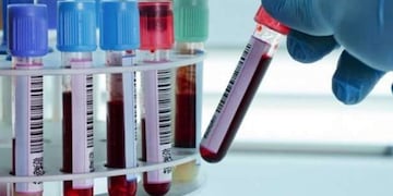 Coronavirus - Gualeguaychú