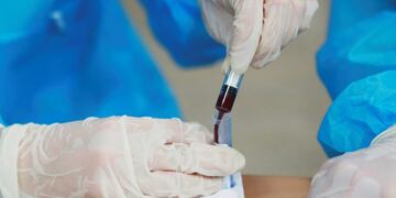 Coronavirus test\u002E