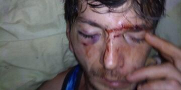 La víctima terminó con golpes en el rostro y todo el cuerpo\u002E