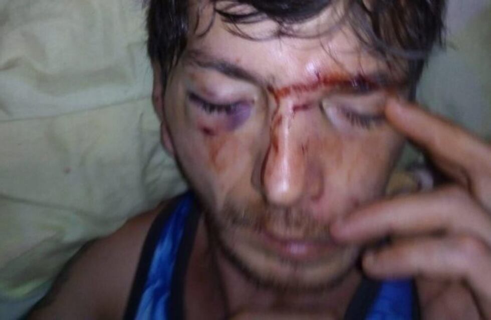 Denuncian que un hipoacúsico sufrió una brutal golpiza en Oberá