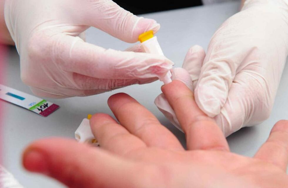 Día mundial contra el VIH/SIDA en Córdoba: uno por uno, los centros de testeos gratuitos