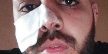 Martín Clemenceau, el joven que recibió la brutal agresión.