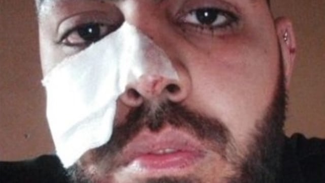 Martín Clemenceau, el joven que recibió la brutal agresión.