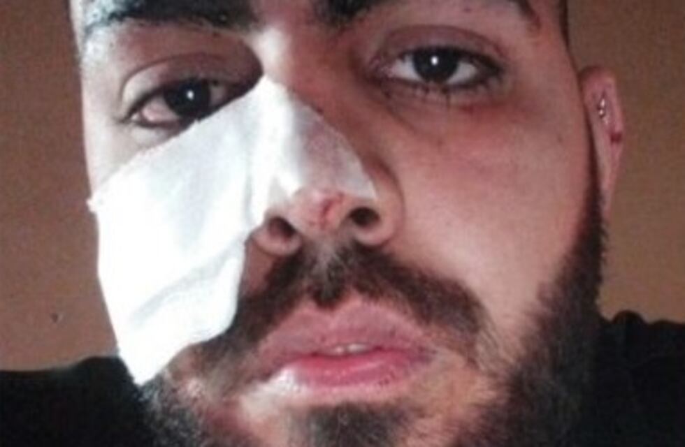 Le reventaron una botella de vidrio en la cara a la salida de un boliche