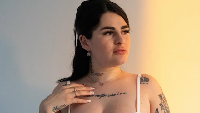 Kami Franco mostró los resultados de un nuevo tratamiento estético al que se sometió.