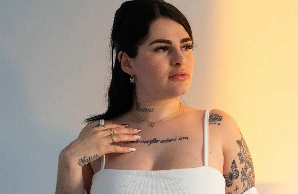 Radical cambio: Kami Franco mostró los resultados de un nuevo tratamiento estético