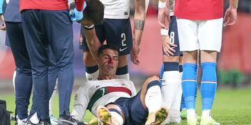Cristiano Ronaldo quedó sangrando por un duro golpe. Foto: Reuters