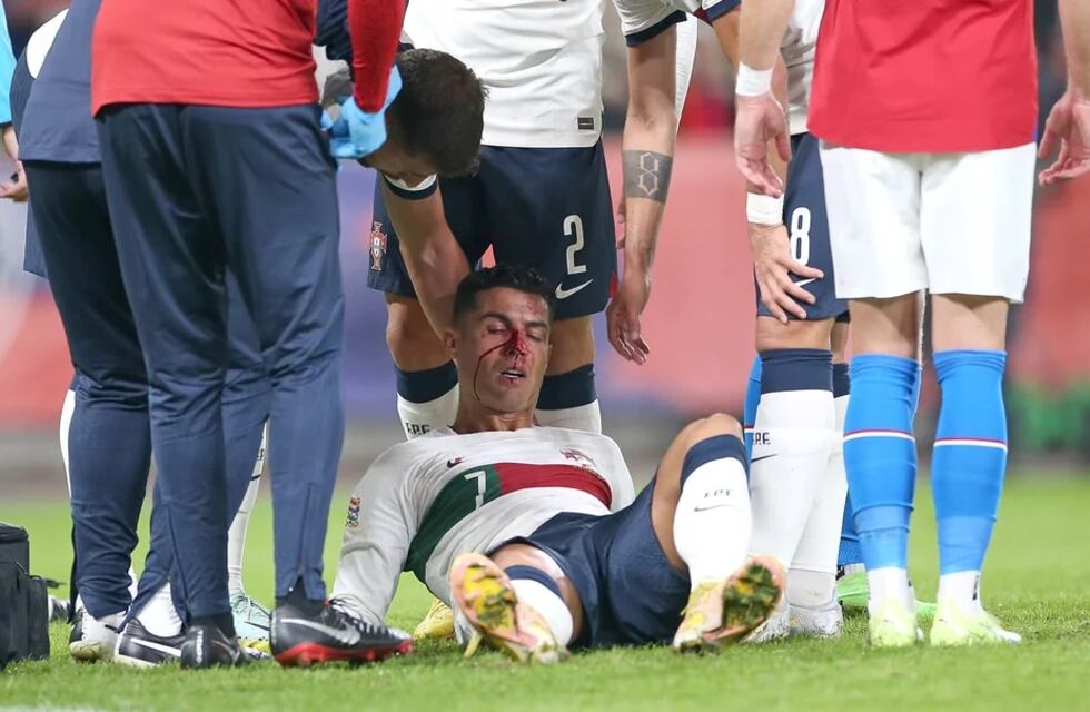 Cristiano Ronaldo recibió un violento golpe en la goleada de Portugal ante República Checa