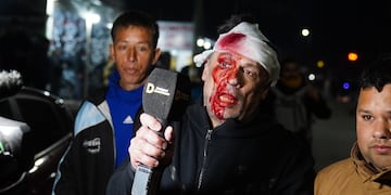 Mercatante fue agredido de un botellazo