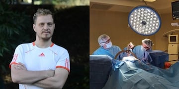 Marcelo Simeoni llegó a lavarse las manos durante 12 horas seguidas pero se curó gracias a una novedosa cirugía.