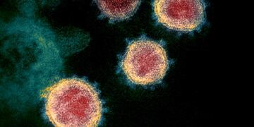 al microscopio. Imagen del Sars-Cov-2 desde un microscopio electrónico. (NIH)