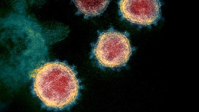 al microscopio. Imagen del Sars-Cov-2 desde un microscopio electrónico. (NIH)