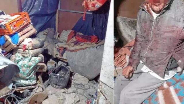 El hombre sufrió heridas graves en el maxilar y otra en el tabique nasal.