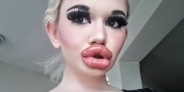 Andrea Ivanova es la mujer con los labios más grandes del mundo.