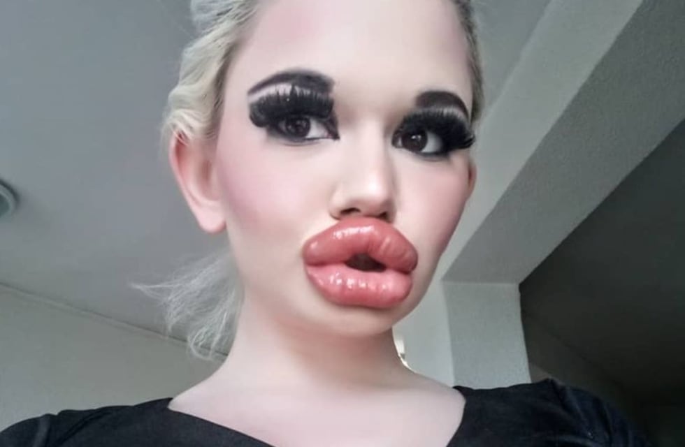Es la mujer con los labios “más grandes del mundo”, tiene más de 20 cirugías y quiere parecerse a una muñeca “Bratz”