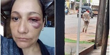 Posadas: joven con presuntos problemas mentales golpeó a una mujer en plena vía publica.