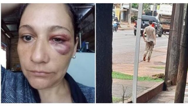Posadas: joven con presuntos problemas mentales golpeó a una mujer en plena vía publica.