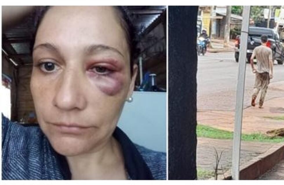 Posadas: joven con presuntos problemas mentales golpeó a una mujer en plena vía publica