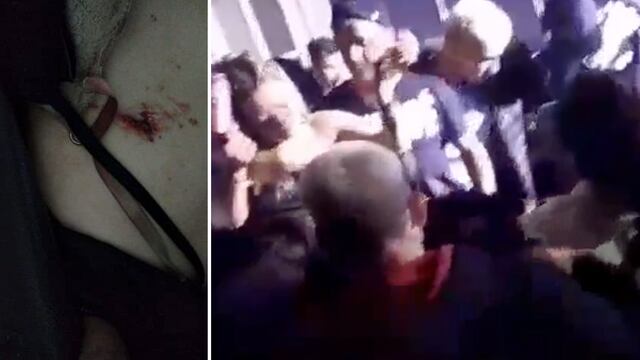Denuncian una agresión en un boliche