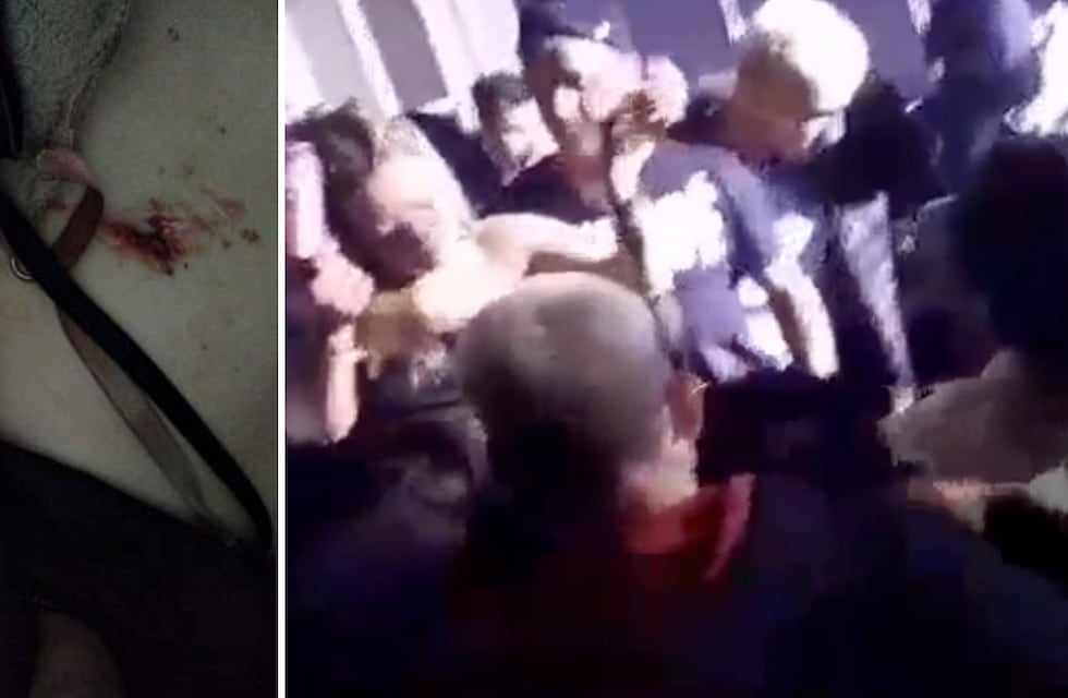 Agredieron a una adolescente en un boliche: recibió un botellazo y una herida en el pecho