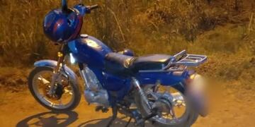 Niño de 7 años se fracturó la pierna tras quedar atrapada en la rueda de una moto