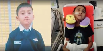 Benjamín tiene 12 años y quedó cuadripléjico tras caer de una moto.