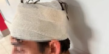 El joven sufrió diferentes heridas producto de la golpiza en Mendoza.