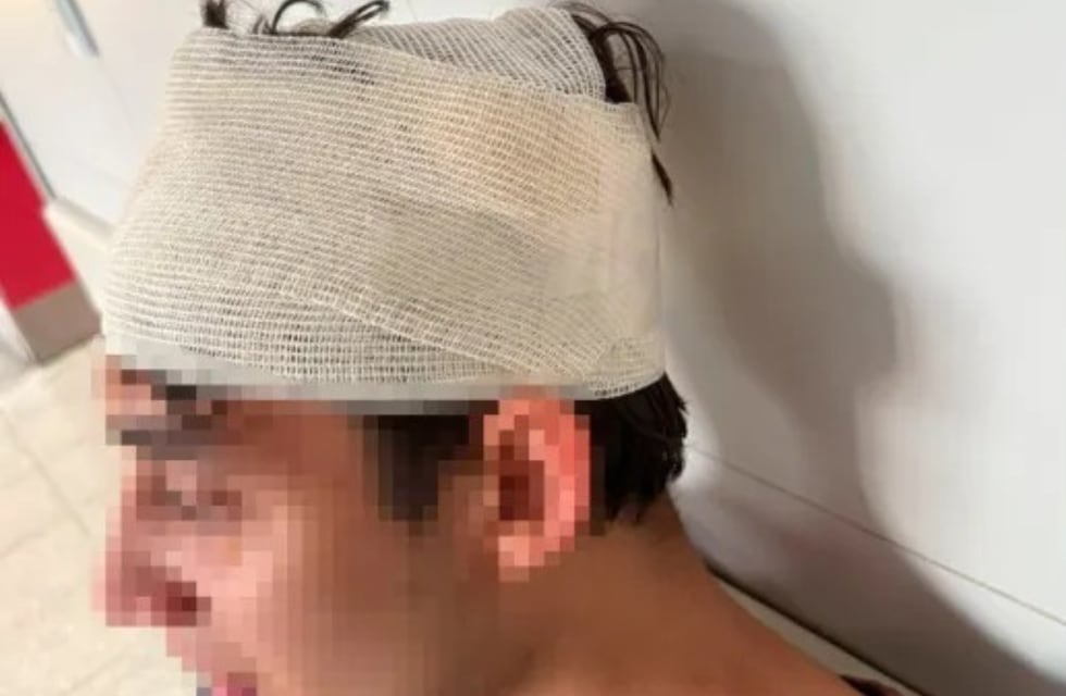 Denunció que rugbiers de Córdoba lo golpearon a la salida de un boliche en Mendoza: “Lleno de sangre”