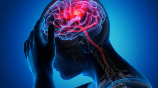Cómo prevenir un ACV isquémico