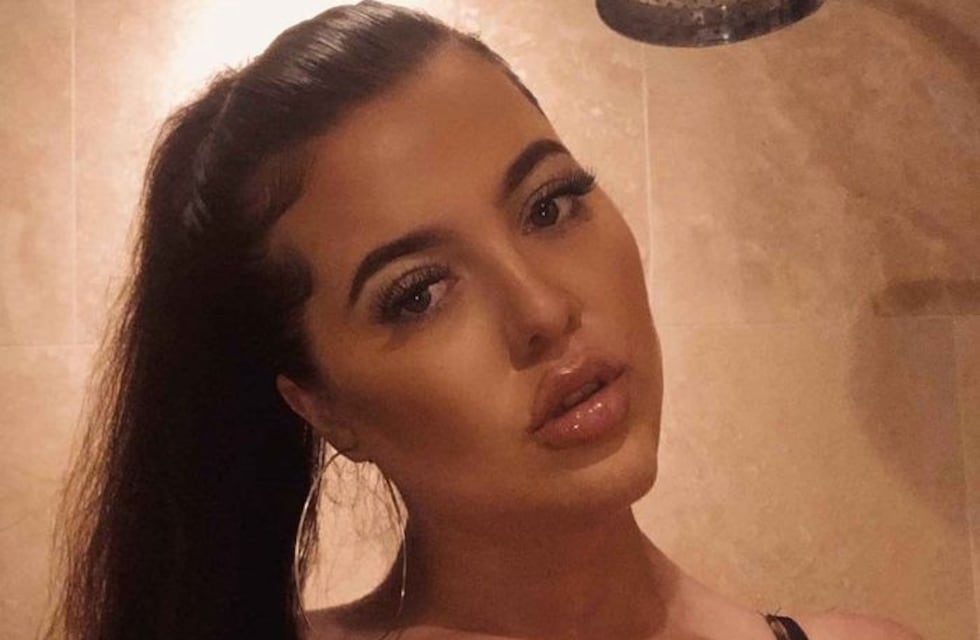 Después de años de dolor, operaron a una mujer que tenía cuatro pechos