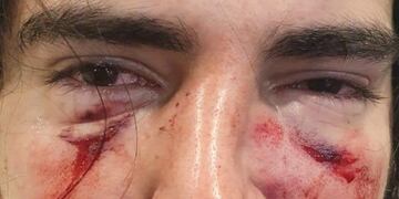 Así quedó el rostro de Lautaro Insúa.